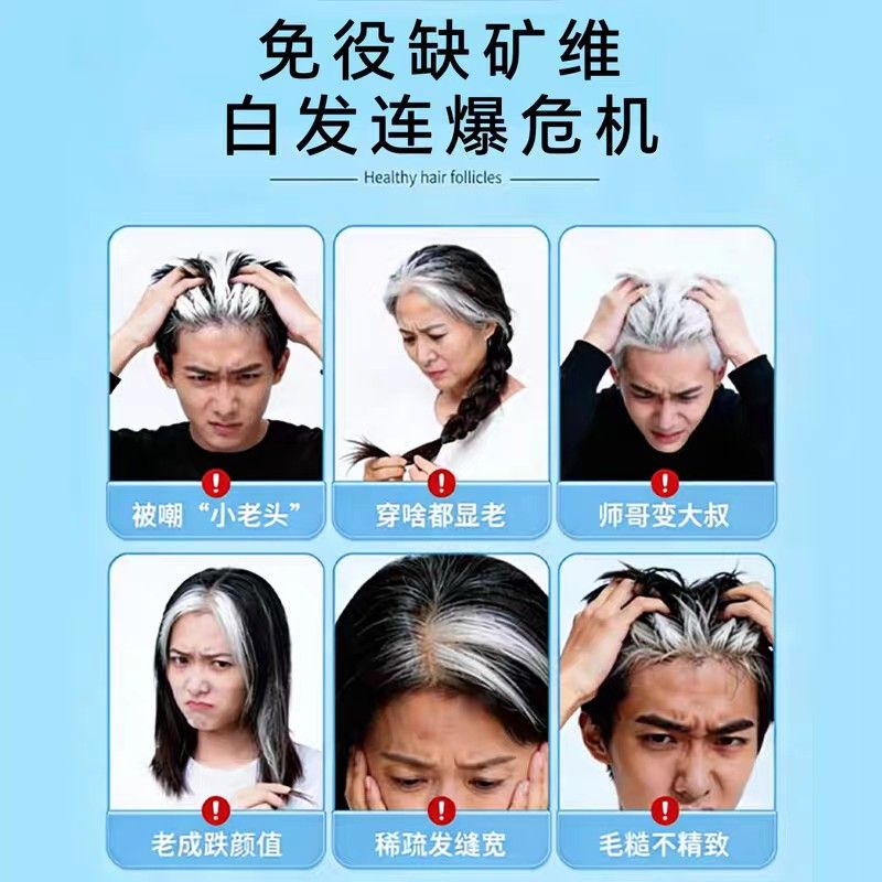 舒/素乌藻油白发脱发可固发发护VSN发乌黑柔茵维生内调白养顺发健