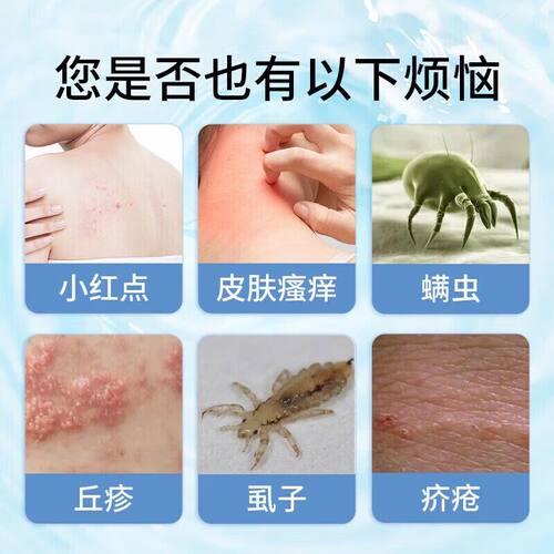 同仁堂硫磺软红膏去阴虱抑菌潮除螨虫皮VLA肤官方舰旗店正品瘙痒