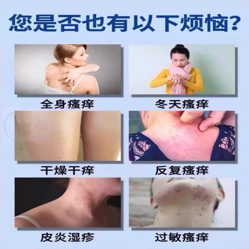 皮康皮王老牌子品正抑菌乳膏湿止痒根去疹顽固炎过敏全身药痒LBV