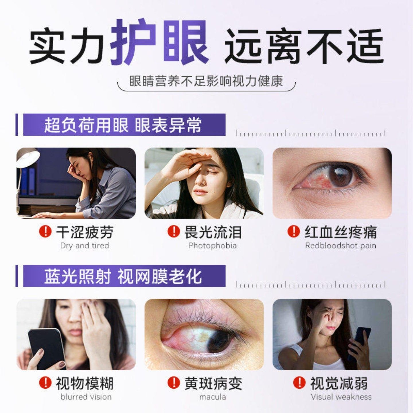 MIZ油【片官方品】黑宝石DHA藻黑醋栗玉正米黄质护眼干涩疲惫x旗