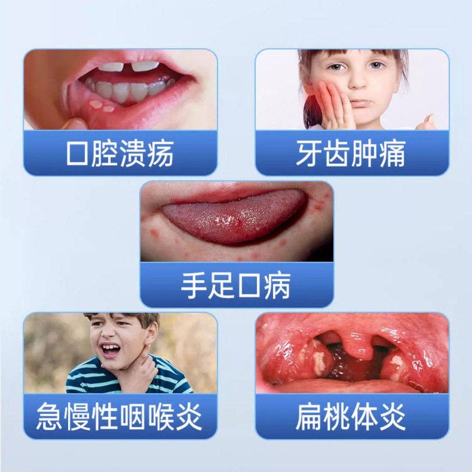 重方组人干扰素a2b喷雾COB剂童手足喉口腔溃疡扁桃咽体咽炎官正儿