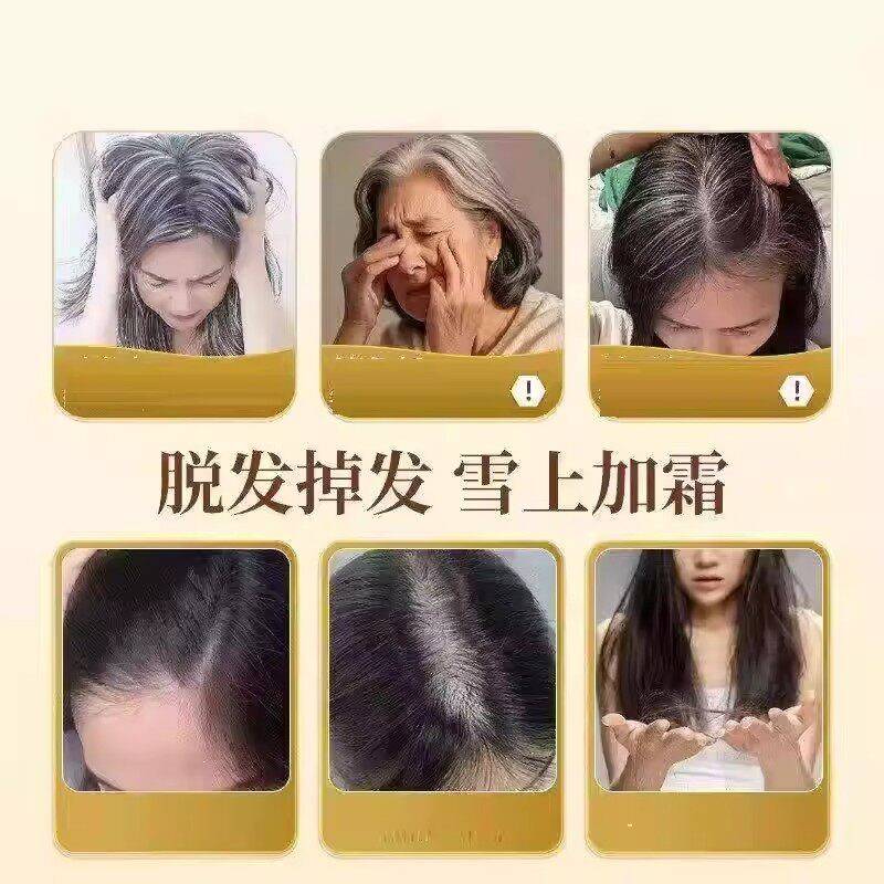【青官方正品JPZ】油轻尔贝维生b乌发白发内素调发线乌鱼丝鱼油