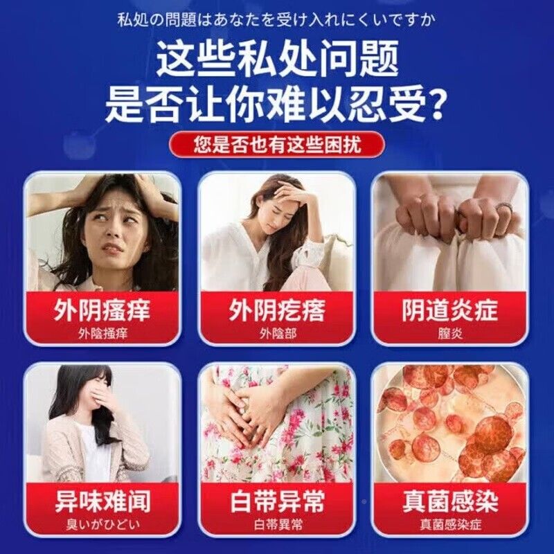 外性阴瘙止痒膏去女私处止痒外阴白痒斑专用抑菌药膏IXO官方旗根