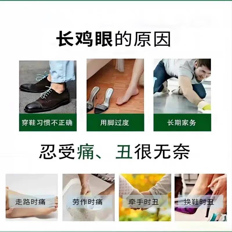 云南除本草鸡眼膏肉老刺脱落无痛硬块茧官方舰旗464店足部跖疣灵