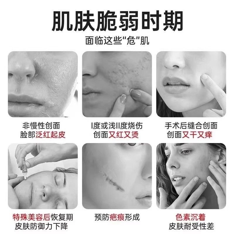重组生长因子凝胶牛KRI碱人性纤维成肤细胞人体皮成长因子表皮修