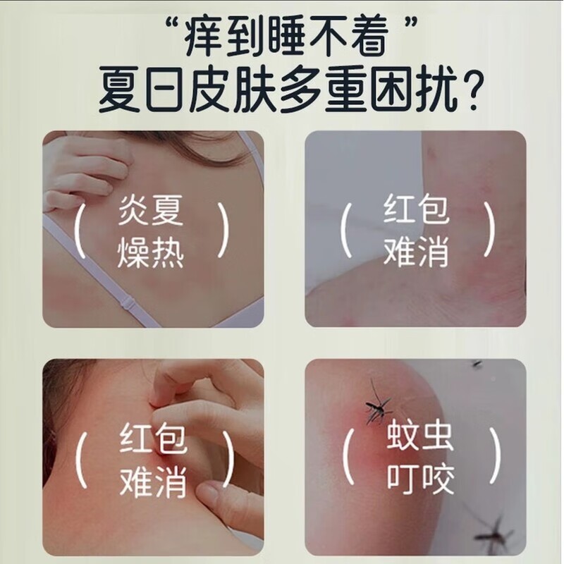 金盏花止痒膏孕婴儿适户外用消防蚊虫咬肿修复舒缓真菌感IZX染正