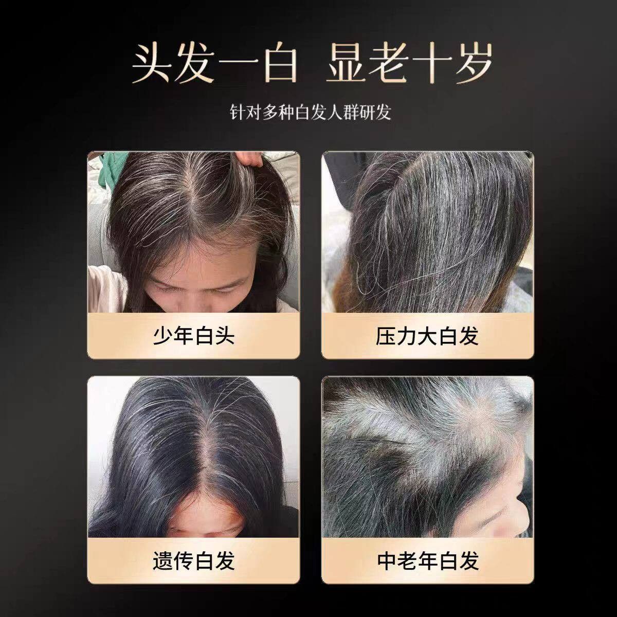 安克乌发原美源少发氨酸黄素维生VAC素叶酸黑发中姜老年白发掉发