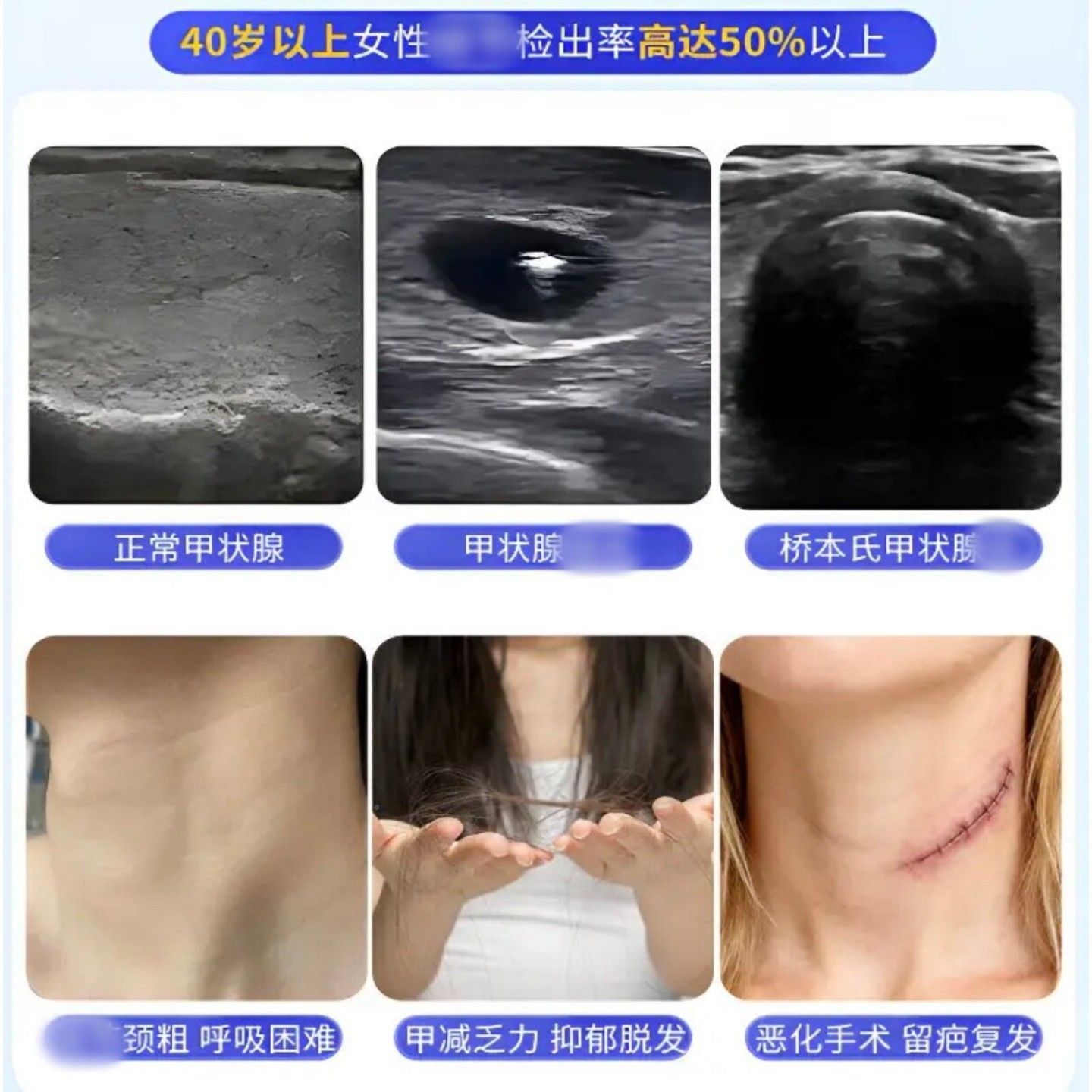 /颗消化节宝 化CJW洁宝 佰原本节快甘草片非南醉茄硒酵母呵护乔本