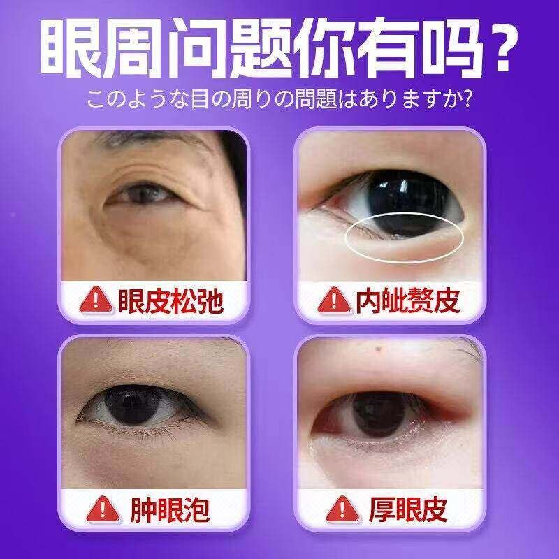 至辉药业眼疼睛浮肿痛水肿胀睁不开肿眼眼泡DFR脂肪型肿型眼部凝