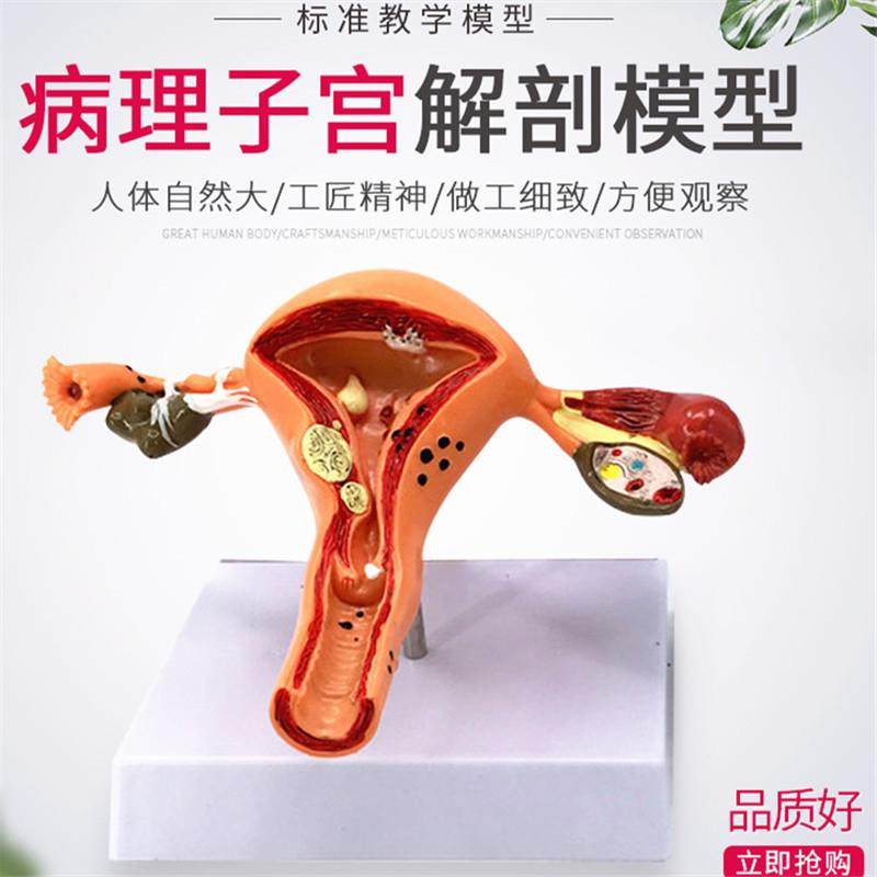 女性大子宫模型放大模型女性生殖解剖模型计划生育示教模型,文具电教/文化用品/商务用品,教学标本/模型,淘宝优惠券,粉丝福利购,淘宝优惠卷