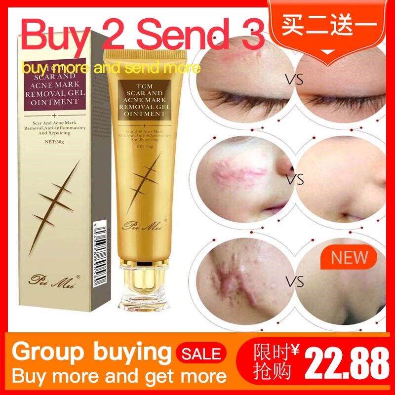 Acne Scar Removal Cream Skin Repair Face body Spots Mark men