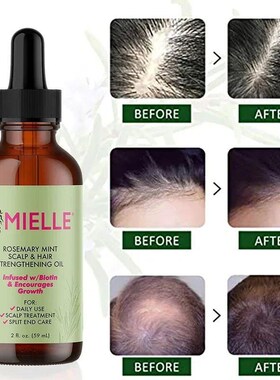 Hair Growth Mint Essential Oil Rosemary Hair Sngthening O