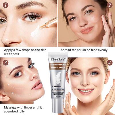 Whitening Freckle Cream Remove Melasma Cream Remove Dark Spo