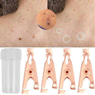 Small Clip Copper Tag Remover Skin Care Wart Remover Micro S