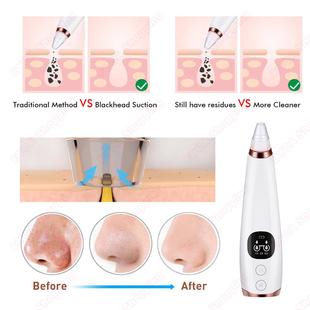 Blackhead Remover English Version Nose T Zone Pore Vacuum