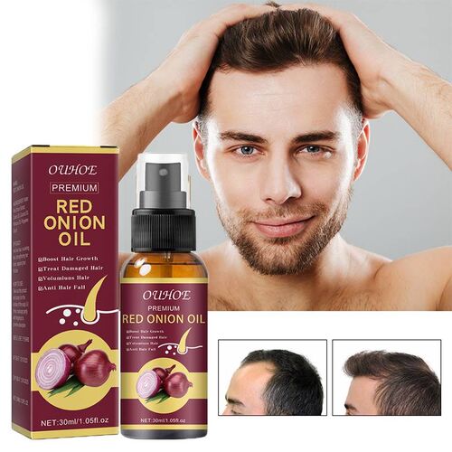 Ginger Hair Growth Essential Oil Fast Grow Anti Hair Loss Pr