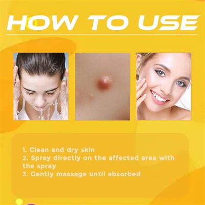 Revitalize Your Skin With Ximonth Bee Venom Spray For Wart