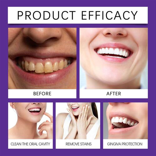 ORALHOE Purple Teeth Whitening Powder Gentle Cleaning Protec