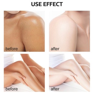 Yellow Peeling Oil Dark Skin Bleaching Remove Arm Knee Legs