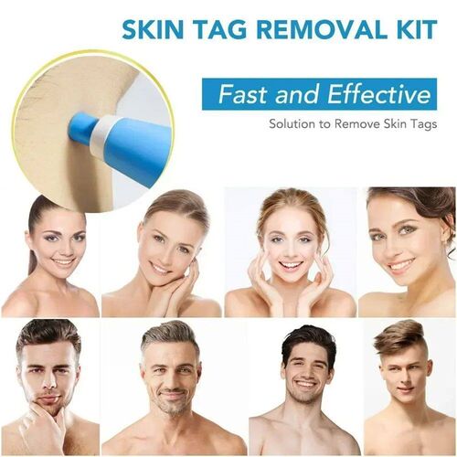 2-IN-1 Auto Skin Tag Removal Tool Kit Painless Skin Label Mo