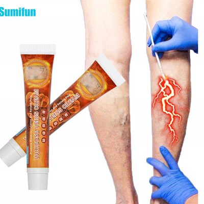 1/2Pcs 20g Varicose Veins Ointmnet Vasculitis Phlebitis Spid