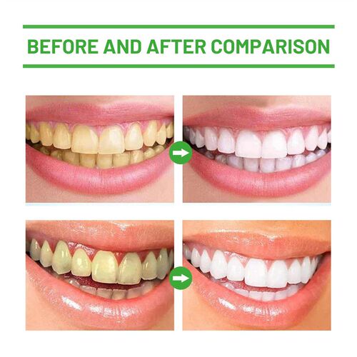 ORALHOE Herbal Oral Mousse - Deep Cleaning for Tartar and Pl