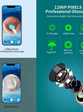 NATFIRE NE6 Wireless Ear Wax Remover Luminous Otoscope Ear C