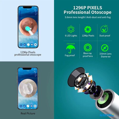 NATFIRE NE6 Wireless Ear Wax Remover Luminous Otoscope Ear C