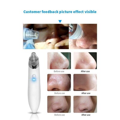 Blackhead remover beauty instrument electric cleanser facial
