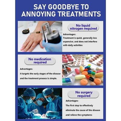 Generaton-2 Laser Says Goodbye To all warts n 7 Days