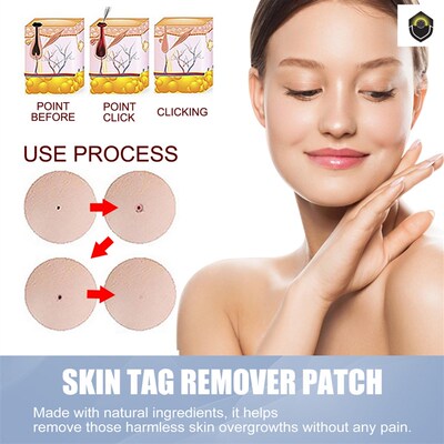 144Pcs Skin Tag Remover Patches Mole Wart Removing Sticker N