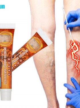 1/2Pcs 20g Varicose Veins Ointmnet Vasculitis Phlebitis Spid