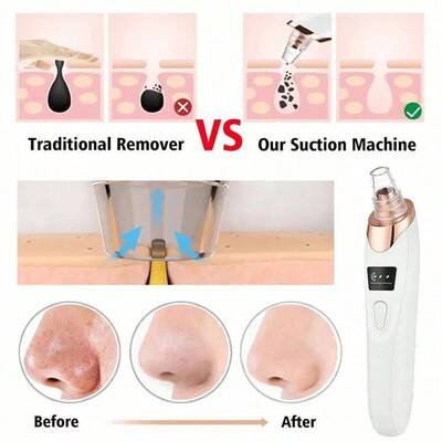 5 Sucton Power Blackhead Remover Pore Vacuum,Women Blackhead