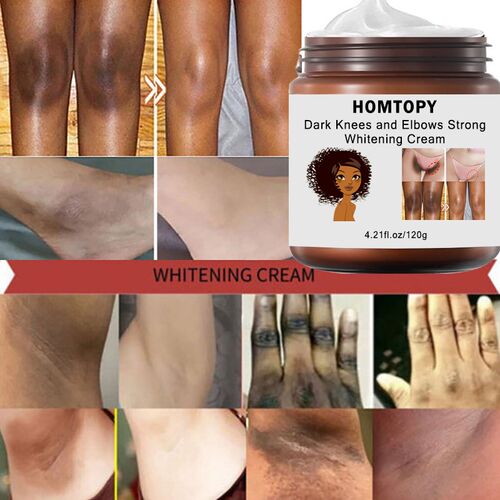 Dark Knees and Elbows Strong Whitening Cream