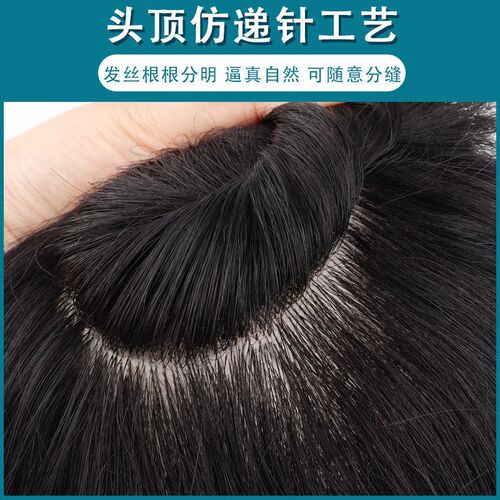 Spot Wig Mens Hair Replenishing Tablets For Real Person Hai