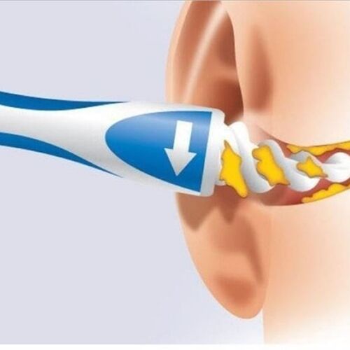 Smart Swab  Earwax Removal Soft Spiral Ear Cleaner Ear-pick