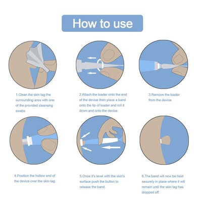 Auto Skin Tag Remover Painless Mole Wart Remover Skin Tag Re