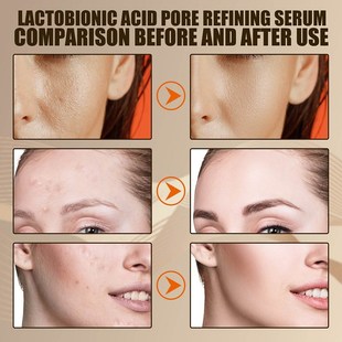 Lactobionic Acid Pore Shrink Face Serum Hyaluronic Acid Mois