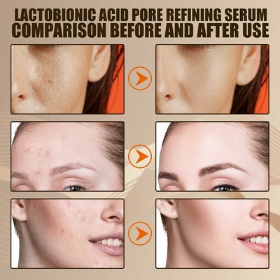 Lactobionic Acid Pore Shrink Face Serum Hyaluronic Acid Mois