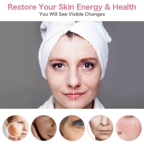 EMS Mesotherapy Electroporation RF Radio Frequency LED Photo