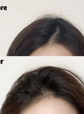 MeiLD蓬松BB发夹为妇女2件/套BB头发Cli