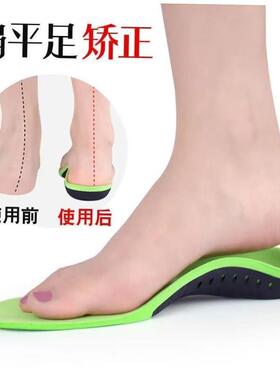 Arch support insoles Flat foot orthopedic insole men women