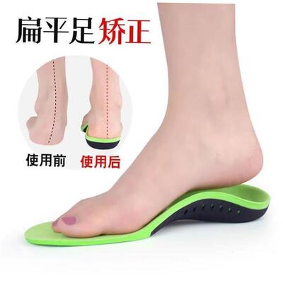Arch support insoles Flat foot orthopedic insole men women