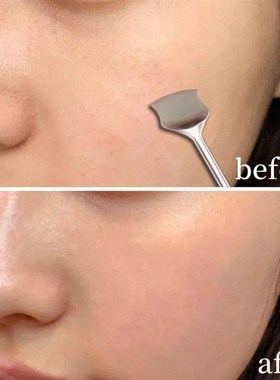 Double Headed Acne Blackhead Remover Cleaner Acne Stainless