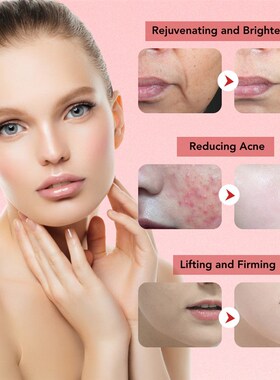 7 in 1 Face Lift Devices EMS RF Microcurrent Skin Rejuvenati