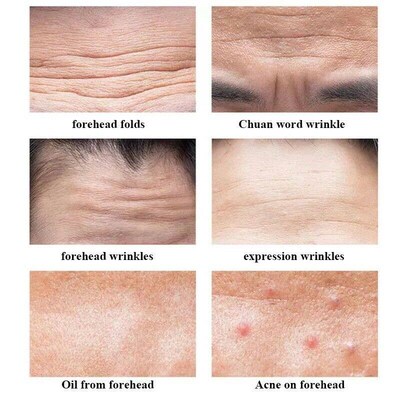 10/5pc Anti-wrinkle Forehead Patches Removal Moisturizing An