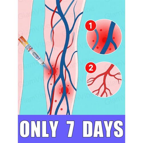 blue light pen solve varicose veins, hot sale leg care tools