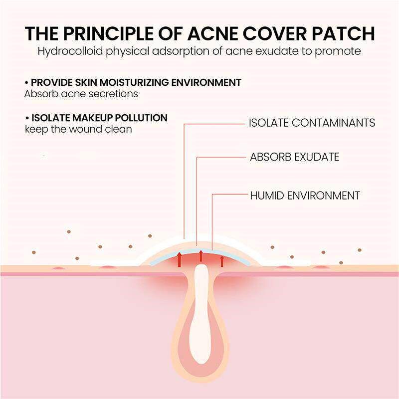 Acne patch to lighten acne spots and repair skin 痘痘贴 淡化 - 实物图