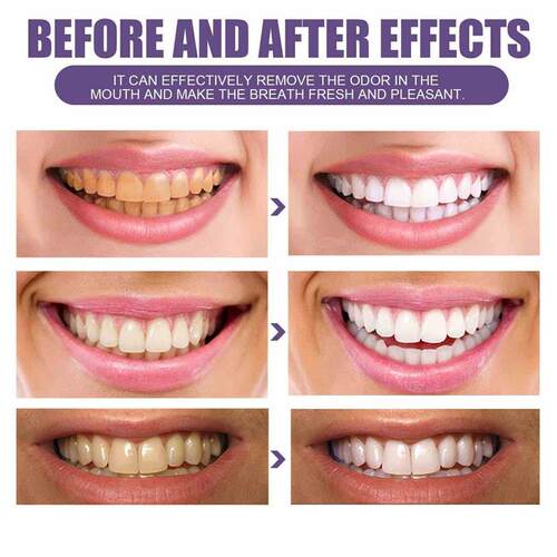 Purple Teeth Cleaning PowderFreshBreath Tartar Calculus Wh