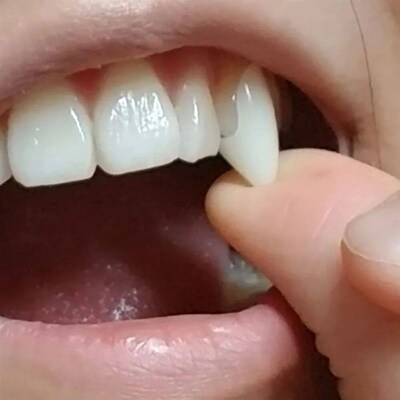 Halloween Decoration Vampire Teeth,1.3-1.9cm Fang Denture,Fa